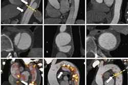 2022 03 21 23 32 8561 2022 03 22 Pet Aortic Syndrome 20220321235334