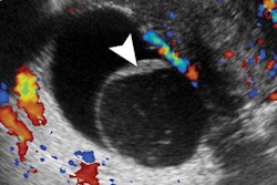 2022 03 22 15 31 4131 2022 03 22 Radiology Pelvic Ultrasound 20220322151331