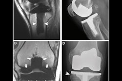 2022 03 22 20 48 4017 2022 03 22 Radiology Endo Image 400