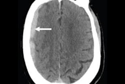 2022 03 24 23 33 7007 2022 03 24 Ajr Vardar 400