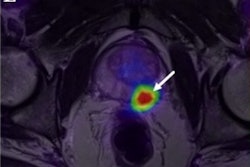 2022 03 30 17 58 0064 2022 03 31 Pet Mri Prostate Cancer Image E 400