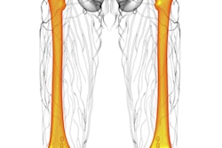 2020 11 19 22 35 3546 Femur Bone And Pelvis 400