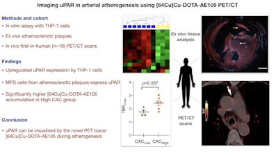 Image courtesy of Atherosclerosis.