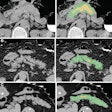 2022 04 04 23 42 0588 2022 04 05 Radiology Ai Diabetes 20220404231435