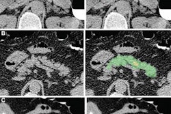 2022 04 04 23 42 0588 2022 04 05 Radiology Ai Diabetes 20220404231435