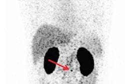 2022 04 06 16 28 0581 2022 04 07 Zr Psma 20220406162755