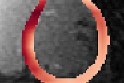 2022 04 07 15 42 9240 2022 04 07 Ai Heart 20220407155807