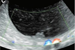 2022 04 12 18 51 7947 2022 04 14 Radiology Deep Learning Ovarian Ultrasound 400