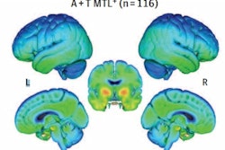 2022 04 15 20 21 4341 2022 04 18 Tau Deposits 400