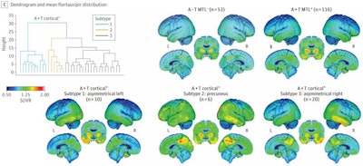 (C) Mean F-18 flortaucipir PET distribution patterns for each study group. A- indicates normal beta-amyloid; A+ indicates elevated beta-amyloid. A-T MTL- indicates normal beta-amyloid without elevated MTL tau; A-T MTL+ indicates normal beta-amyloid and elevated MTL tau. A+T MTL- indicates preclinical Alzheimer's disease without elevated MTL tau; A+T MTL+ indicates preclinical Alzheimer's disease and elevated MTL tau. MTL = medial temporal lobe; SUVR = standardized uptake value ratio. Image courtesy of JAMA Neurology.
