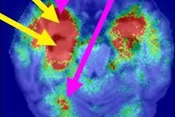 2022 04 19 20 13 0975 2022 04 19 Fujifilm Touts Study Image 400