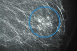 2022 04 20 21 38 2174 2022 04 19 Radiology Mammo Ai Workload 20220420212450