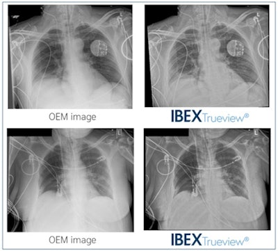 Examples of postprocessed enhanced OEM and Trueview images. Images courtesy of Acta Radiologica.