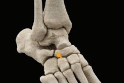 2022 04 21 20 43 1640 2022 04 20 Ajr Skeleton Foot 20220421202441