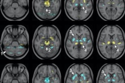 2022 04 22 18 07 6117 2022 04 22 Ai Pet Brain 20220422184123