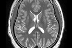2022 04 26 17 12 2436 2022 04 26 Mri Premature Kids Autism Figure2 400