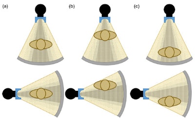 Figure 3. Anterior (top) and lateral (bottom) positions of the x-ray tube when the patient is (a) in the center of the gantry (b) shifted anteriorly (c) shifted posteriorly with respect to the beam output. Reproduced from Barreto et al.5