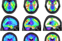 2022 04 27 17 08 7579 2022 04 28 Pet Braak Stages 20220427173416