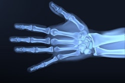 2017 11 15 23 12 3096 Hand X Ray 400
