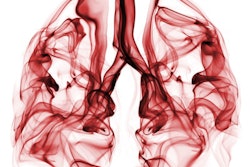 2021 09 27 19 54 8375 Smoky Lungs 400