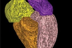 2022 05 02 21 21 0021 2022 05 03 Volumetry Hypertension 20220502211528