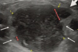 2022 05 04 00 36 7149 2022 05 03 Arrs Ultrasound Micorlobulation 400