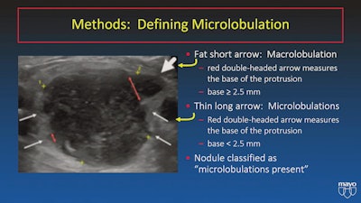 The Thyroid Imaging Reporting and Data System (TI-RADS) has been used as a standardized method for classifying thyroid nodules. It was introduced by the American College of Radiology in 2017, but researchers at the 2022 ARRS meeting presented abstracts showing the system can be improved. This image from researchers at the Mayo Clinic in Arizona shows macro- and microlobulations on thyroid ultrasound.