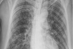 2022 05 04 01 28 3077 2022 05 04 Lung Perfusion 20220504014645