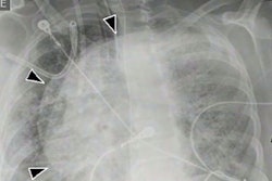 2022 05 04 16 14 5400 2022 05 04 Prone X Ray 400
