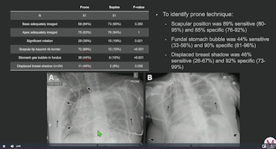 prone x ray images