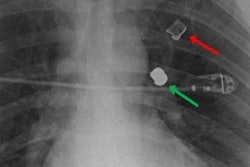 2022 05 04 23 51 7196 2022 05 04 Arrs Imaging Ballistic Injuries Figure 20220504230809