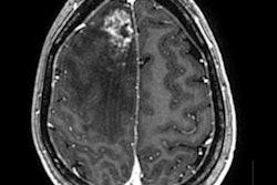 2022 05 08 19 14 3686 2022 05 08 Ismrm Zaharchuk Image2 400