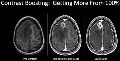 Deep learning has the ability to boost the effect of 100% contrast.