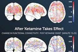 2022 05 09 18 17 1292 2022 05 09 Kernel Cybin 400