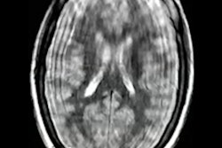 2022 05 09 21 02 3086 2022 05 09 Ismrm Simcock Mri Pediatric 400