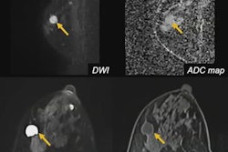 2022 05 10 15 44 0724 2022 05 09 Ismrm Ota Dwi Weighted Imaging 20220510160046