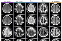 2022 05 10 17 09 1354 2022 05 10 Ismrm Mr Fingerprinting 400
