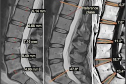 2022 05 11 21 38 7830 2022 05 10 Ismrm Mri Spine 400