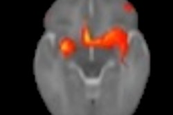 2022 05 12 02 12 6639 2022 05 12 Lebel Baby Brain Image 400