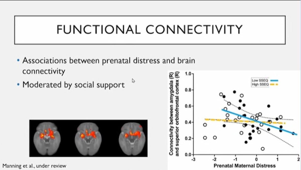 COVID-19 in pregnancy: implications for fetal brain development