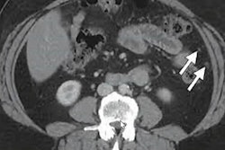 2022 05 12 14 24 6648 2022 05 11 Ismrm Mri Ct Ovarian Cancer 400