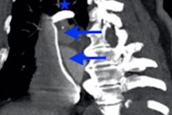 2022 05 12 15 34 0905 2022 05 13 Contrast Pooling Ct Cardiac Arrest Figure1 20220512152114