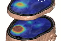 2022 05 16 23 51 9059 2022 05 12 Ismrm De Graaf Dmi 400