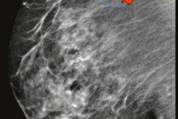 2022 05 17 21 22 3532 2022 05 17 Sbi Ikeda Adenopathy 400