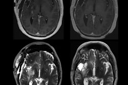 2022 05 18 00 29 6624 2022 05 18 Ismrm Marion Smits Presentation 400