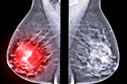 2022 05 20 17 54 1160 X Ray Mammogram Mediolateral 400