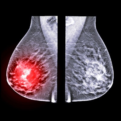 2022 05 20 17 54 1160 X Ray Mammogram Mediolateral 400