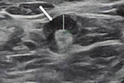 2022 05 20 21 28 0348 2022 05 18 Ajr Lymphadenopathy Ultrasound 20220520210923