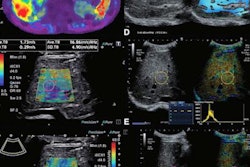 2022 05 24 21 05 3207 2022 05 24 Radiology Liver Ultrasound Mri 20220524213248