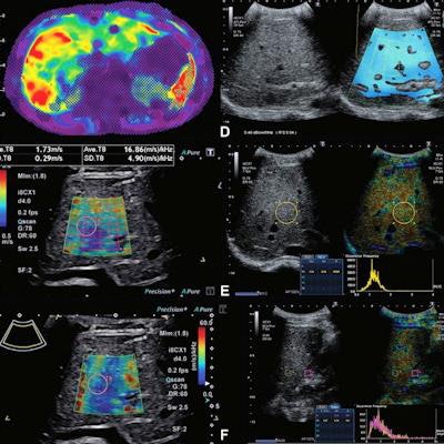 2022 05 24 21 05 3207 2022 05 24 Radiology Liver Ultrasound Mri 20220524213248